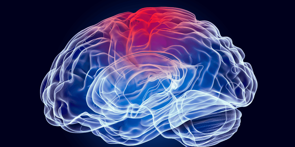 What type of seizure affects both sides of the brain?